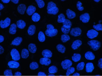 Anti-BCL9L Antibody