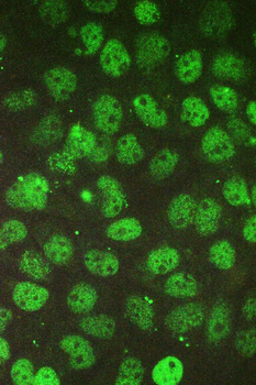 Anti-BCL9L Antibody