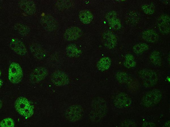 Anti-BCL9L Antibody