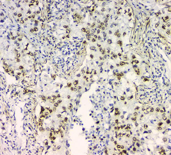 Anti-BCL9L Antibody