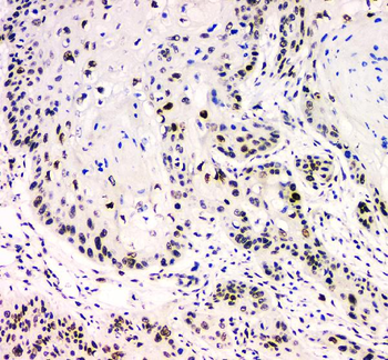 Anti-BCL9L Antibody
