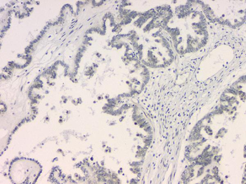 Anti-BCL9L Antibody