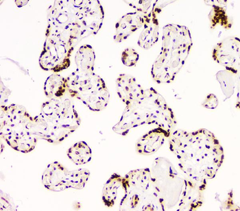 Anti-BCL9L Antibody
