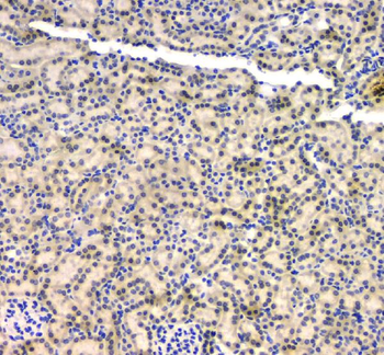 Anti-BCL9L Antibody