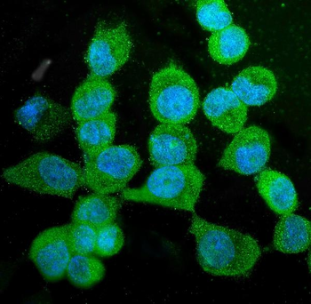KIF15 Antibody