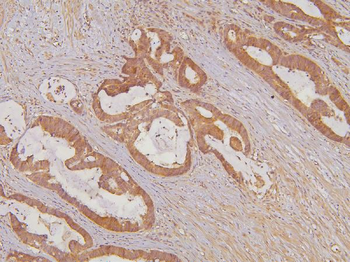 KIF15 Antibody