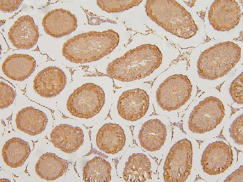 KIF15 Antibody