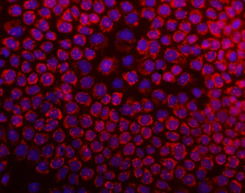 Anti-DARS2 Antibody
