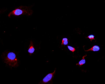 Anti-DARS2 Antibody