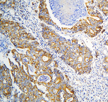 Anti-DARS2 Antibody