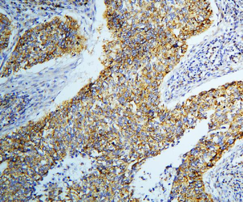 Anti-DARS2 Antibody