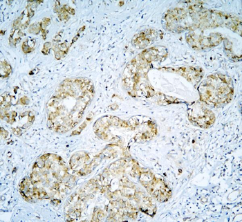 Anti-DARS2 Antibody