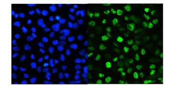 Anti-SMARCAD1 Antibody