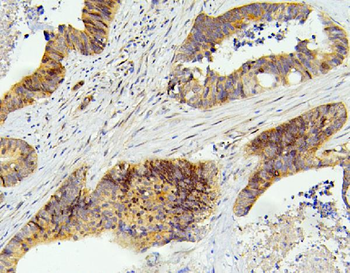 Anti-SMARCAD1 Antibody