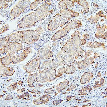 Anti-SMARCAD1 Antibody