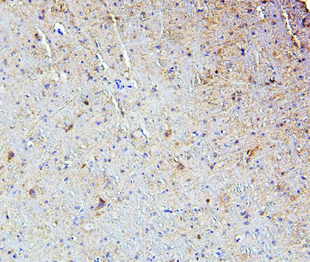 Anti-SMARCAD1 Antibody