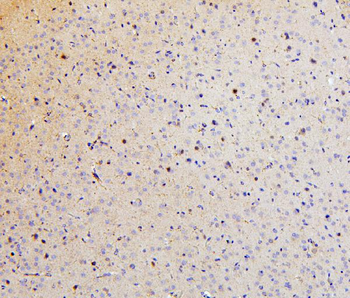 Anti-SMARCAD1 Antibody