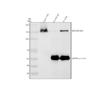Anti-SMARCAD1 Antibody