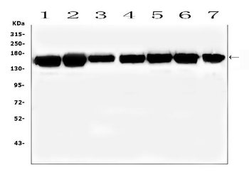 Anti-SMARCAD1 Antibody
