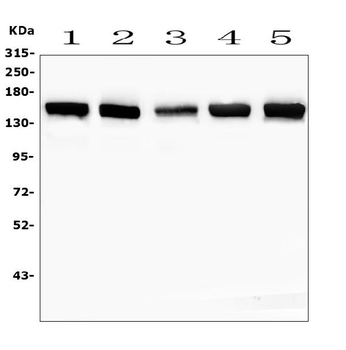 Anti-SMARCAD1 Antibody