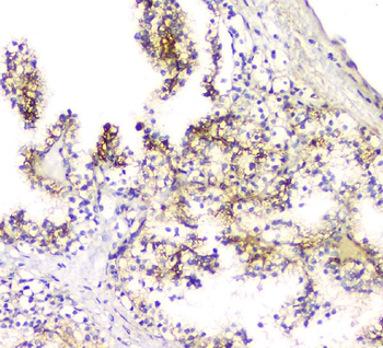 Anti-SCN4B Antibody