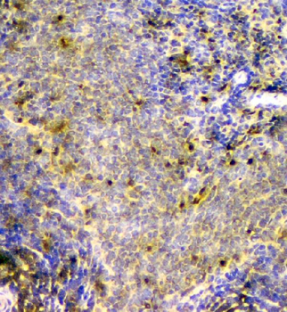 Anti-SCN4B Antibody