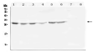 Anti-SCN4B Antibody