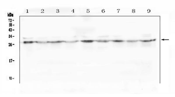 Anti-SCN4B Antibody