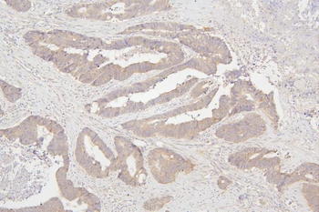 Anti-Semaphorin 3B/SEMA3B Antibody