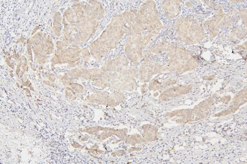 Anti-Semaphorin 3B/SEMA3B Antibody