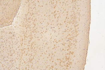 Anti-Semaphorin 3B/SEMA3B Antibody
