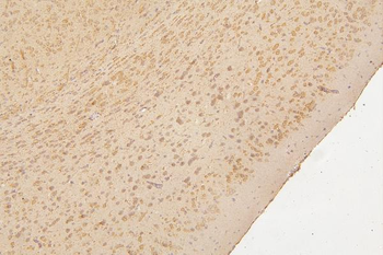 Anti-Semaphorin 3B/SEMA3B Antibody