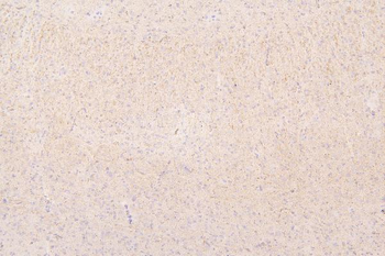Anti-Semaphorin 3B/SEMA3B Antibody