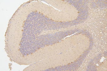 Anti-Semaphorin 3B/SEMA3B Antibody