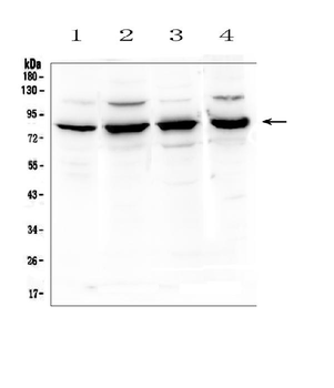 Anti-Semaphorin 3B/SEMA3B Antibody