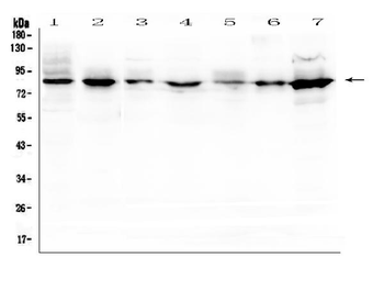 Anti-Semaphorin 3B/SEMA3B Antibody