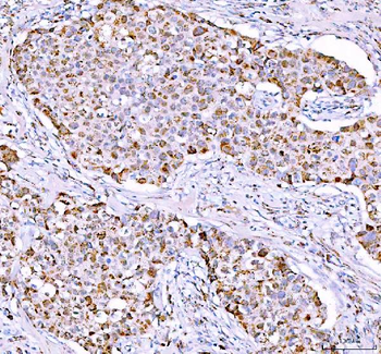 Anti-PPA2 Antibody