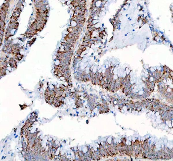 Anti-PPA2 Antibody