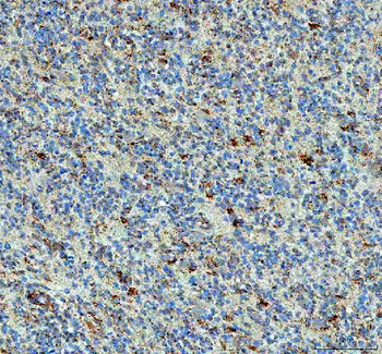 Anti-PPA2 Antibody