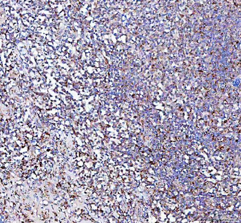 Anti-PPA2 Antibody