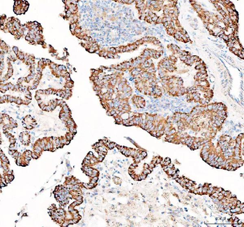 Anti-PPA2 Antibody