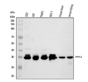 Anti-PPA2 Antibody