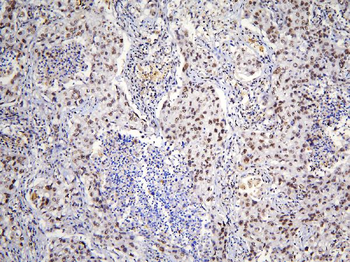 Anti-TAF12 Antibody
