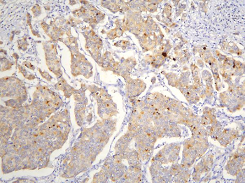 Anti-TAF12 Antibody
