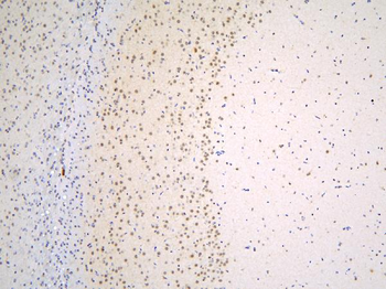 Anti-TAF12 Antibody