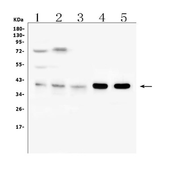 ARP2/3 subunit 1B/ARPC1B Antibody