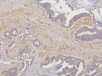 Anti-RAB3GAP2 Antibody