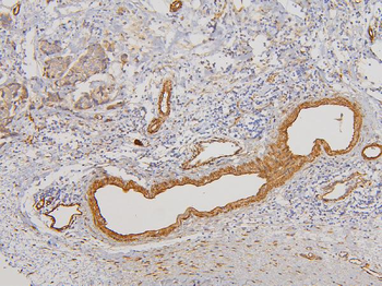 Anti-RAB3GAP2 Antibody