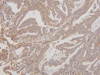 Anti-RAB3GAP2 Antibody
