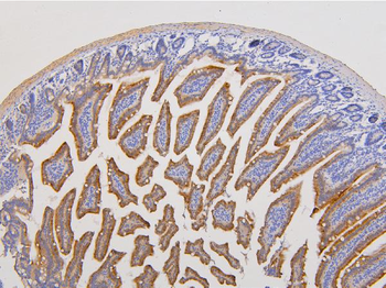 Anti-RAB3GAP2 Antibody